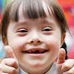 11 Facts About Down Syndrome | DoSomething.org