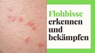 Flohbisse & Flohstiche (erkennen und bekämpfen) - Wie sehen Flohbisse ...