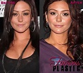 Jenni Farley JWoww Plastic Surgery Before and After facelift - Star ...