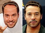 Jeremy Piven Hair Transplant - Hair Loss & Technical Analysis