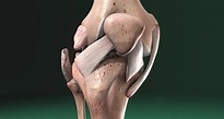 LCL (Lateral Collateral Ligament) Injury
