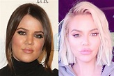 Khloe Kardashian finally admits to plastic surgery: Before and After ...