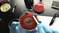 吲哚试验---鉴定大肠埃希菌的实验示范_腾讯视频