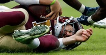 Gruesome Photo Of Alex Smith's Injury Shows Exact Moment When His Leg ...