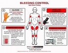 Stop The Bleed - Dual Treatment Kit - Rescue Essentials