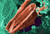 Imagem gratuita: numerosos, protozoários, ameboides, bactérias ...