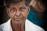 Leprosy: What It Is, What It’s Not, and How You Can Help - Embrace A ...