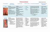 TIPOS DE HERIDAS CUADRO | Esquemas y mapas conceptuales de Enfermedades ...