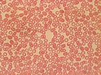 células sanguineas: Fichero de Hematología