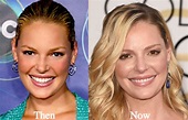 Katherine Heigl Plastic Surgery Before and After Photos - Latest ...