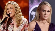 Carrie Underwood's Lips – What Happened to the American Singer ...