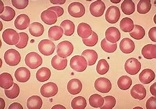 Blog Hematología Básica: Hematología, Elementos figurados de la sangre