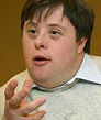 Discapacidad y salud: La obesidad y el síndrome de Down