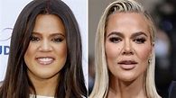Plastic Surgeon Decodes Khloé Kardashian's Transformation - Exclusive