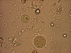 Blastocystis Parasite Blog: Entamoeba