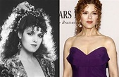Bernadette Peters Plastic Surgery Before and After Pictures | Celebrity ...