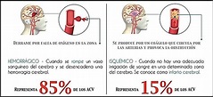 Tipos de ACV (accidente cerebro vascular) | Download Scientific Diagram