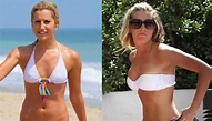 Ashley Tisdale Before And After Breast Implants Surgery | Celebrity ...
