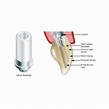 10 Dental Implant UCLA Plastic Castable Abutment Titanium Base Internal ...