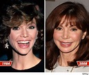 Victoria Principal Plastic Surgery Before and After Facelift and Botox ...