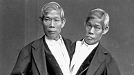 Remembering Chang and Eng, the original Siamese twins - ABC News