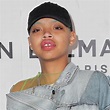 Model Slick Woods Says Her Life Was Saved After Suffering Seizure - E ...