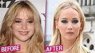 Jennifer Lawrence Before & After Plastic Surgery Makeover Exposed