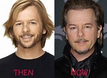 David Spade Plastic Surgery Before & After ...