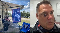 Greg Bloch: Wisconsin Man says He Was Beaten Over Trump Flag | Heavy.com