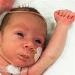Your Preemie's Growth & Developmental Milestones - HealthyChildren.org