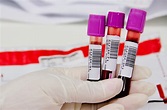 Exame de Sangue | Tipos de Check-up e tempo de jejum