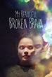 My Beautiful Broken Brain (Film, 2016) — CinéSérie