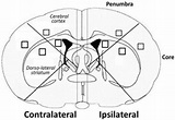 Schematic drawing of monitored brain regions. To monitor the direct ...