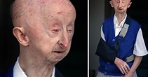 Alan Barnes: Community raises £5,000 for disabled man after violently ...