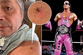Bret ‘The Hitman’ Hart finally announces cancer diagnosis at 62