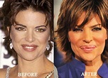 How much Plastic Surgery has Lisa Rinna had over the years?