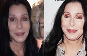 Cher Ungeschminkt : Diese Celebrities Zeigen Ihr Wahres Gesicht Ganz ...