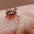 Rocky Mountain Spotted Fever - Dermatologist in Bloomington, IN ...