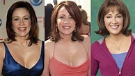 Patricia Heaton Plastic Surgery Before and After Pictures 2021 | Never ...