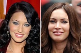 Celebrity Nose Jobs - Before & After - Irish Mirror Online