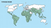 Fiebre Tifoidea | Fiebre Entérica | PortalCLÍNIC