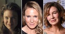 Renee Zellweger Before And After Plastic Surgery To See Her Dramatic ...