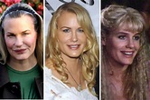 Actress Daryl Hannah Before And After Plastic Surgery