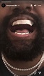 Kanye West's 'titanium teeth' are permanent, rep says