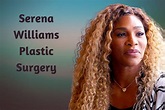 A look at Serena Williams' before and after plastic surgery results ...
