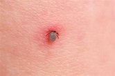 What Does A Tick Bite Look Like In A Dog Dogwalls Ima - vrogue.co