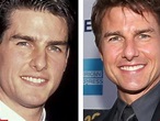 Tom Cruise's Teeth Before And After: When Did The Actor Fix His Teeth?
