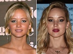 Jennifer Lawrence, Before and After | Jennifer lawrence plastic surgery ...