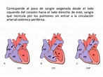 Cortocircuitos de izquierda derecha(cardiopatias congenitas)