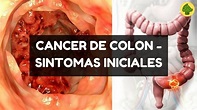 Estos Son Los SINTOMAS INICIALES DEL CANCER DE COLON « Noticias.Nathy
